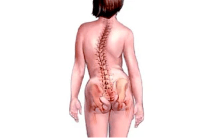 A méhnyak osteochondrosis kialakulásának okai