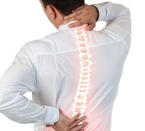 a gerinc osteochondrosisa egy férfiban